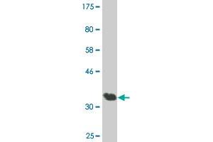 Western Blot detection against Immunogen (36. (AATK antibody  (AA 161-260))