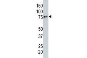 Anti-HA tag antibody testing a tagged recombinant protein. (HA-Tag antibody)