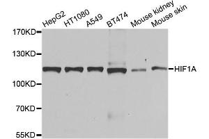 Western blot analysis of extracts of various cell lines, using HIF1A antibody. (HIF1A antibody)