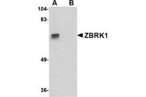 Western blot analysis of ZBRK1 in A-20 lysate with this product at 1 μg/ml in (A) the absence and (B) the presence of blocking peptide.