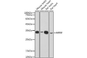 Western blot analysis of extracts of various cell lines, using MRRF antibody (ABIN7268589) at 1:1000 dilution. (MRRF antibody)