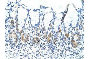 Image no. 1 for anti-Adenosine Deaminase, tRNA-Specific 1 (ADAT1) (C-Term) antibody (ABIN6736282) (ADAT1 antibody  (C-Term))