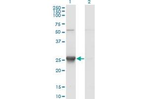 Western Blot analysis of TK1 expression in transfected 293T cell line by TK1 monoclonal antibody (M12), clone 3A8. (TK1 antibody  (AA 1-234))