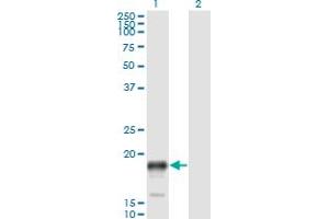 Western Blot analysis of PSCA expression in transfected 293T cell line by PSCA monoclonal antibody (M02), clone 1E1. (PSCA antibody  (AA 23-95))