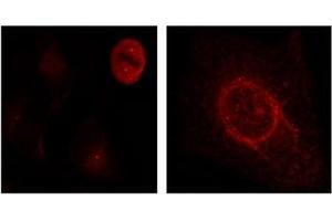 Image no. 3 for anti-Mitogen-Activated Protein Kinase 1/3 (MAPK1/3) (pThr187), (pTyr204) antibody (ABIN197000) (ERK1/2 antibody  (pThr187, pTyr204))