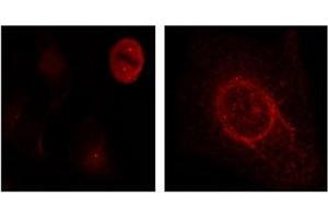 Image no. 3 for anti-Mitogen-Activated Protein Kinase 1/3 (MAPK1/3) (pThr187), (pTyr204) antibody (ABIN197000) (ERK1/2 antibody  (pThr187, pTyr204))