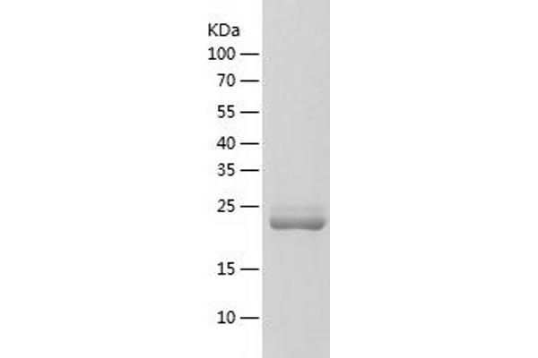 EBI3 Protein (AA 23-228) (His-IF2DI Tag)