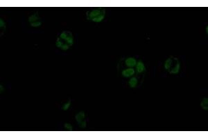 Immunofluorescence staining of MCF7 Cells with ABIN7127801 at 1:50, counter-stained with DAPI. (Recombinant STAG2 antibody)