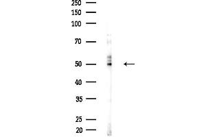 anti-Potassium Inwardly-Rectifying Channel, Subfamily J, Member 4 (KCNJ4) (Internal Region) antibody