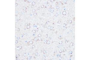 Immunohistochemistry of paraffin-embedded mouse brain using TSC2 Rabbit pAb (ABIN1683176, ABIN5663676 and ABIN7101314) at dilution of 1:100 (40x lens). (Tuberin antibody)