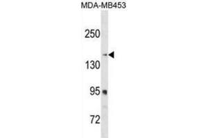 Western Blotting (WB) image for anti-Ribosome Binding Protein 1 (RRBP1) antibody (ABIN3000248) (RRBP1 antibody)