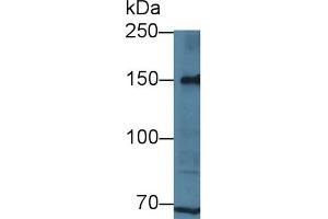 Detection of LRP8 in Human Hela cell lysate using Polyclonal Antibody to Low Density Lipoprotein Receptor Related Protein 8 (LRP8) (LRP8 antibody  (AA 696-941))