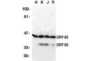 Western blot analysis of DFF45 in HeLa (H), K562 (K) Jurkat (J), and Raji (R) cell lysates with DFF45 antibody at 2μg/ml. (DFFA antibody  (AA 2-21))