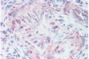 Anti-MLNR antibody  ABIN1049065 IHC staining of human uterus, vessel. (Motilin Receptor antibody  (C-Term))