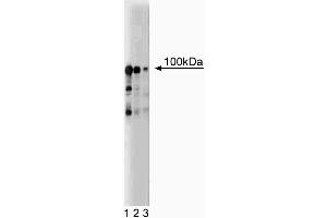 Western blot analysis of UBE3A on a EB-1 cell lysate (Human B lymphoblast, Burkitt's lymphoma, ATCC HTB-60). (ube3a antibody  (AA 501-712))