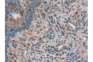Detection of HMWK in Rat Ovary Tissue using Polyclonal Antibody to High Molecular Weight Kininogen (HMWK) (Kininogen (HMW) antibody  (AA 214-475))