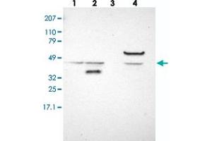 Western blot analysis of Lane 1: RT-4, Lane 2: EFO-21, Lane 3: U-138 MG, Lane 4: Liver, Lane 5: Tonsil with ACOT4 polyclonal antibody .