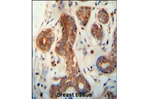 CEPT1 antibody immunohistochemistry analysis in formalin fixed and paraffin embedded human breast tissue followed by peroxidase conjugation of the secondary antibody and DAB staining. (CEPT1 antibody  (N-Term))
