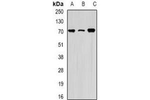 Western blot analysis of HSPA1L expression in Hela (A), THP1 (B), mouse testis (C) whole cell lysates.