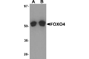 Western Blotting (WB) image for anti-Forkhead Box O4 (FOXO4) (N-Term) antibody (ABIN1031692) (FOXO4 antibody  (N-Term))