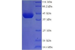 SDS-PAGE (SDS) image for Orofacial Cleft 1 Candidate 1 (OFCC1) (AA 3-231), (partial) protein (His-SUMO Tag) (ABIN5711501)