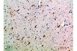 Immunohistochemical analysis of paraffin-embedded human-brain, antibody was diluted at 1:200 (KLRK1 antibody  (AA 167-216))