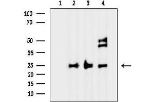 Western blot analysis of lysates from various samples, using PROK1 Antibody.