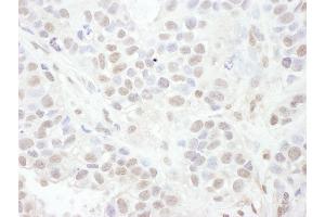 Immunohistochemistry (IHC) image for anti-Lymphoid Enhancer-Binding Factor 1 (LEF1) (AA 349-399) antibody (ABIN7454920)