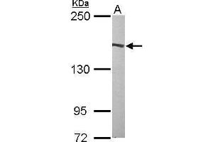 WB Image Sample (50 ug of whole cell lysate) A: Mouse brain 5% SDS PAGE antibody diluted at 1:1000 (Flightless I antibody  (Internal Region))
