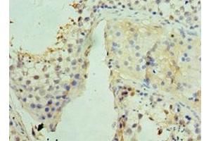 Immunohistochemistry of paraffin-embedded human testis tissue using ABIN7159832 at dilution of 1:100 (UCP1 antibody  (AA 1-307))