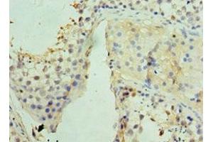 Immunohistochemistry of paraffin-embedded human testis tissue using ABIN7159832 at dilution of 1:100 (UCP1 antibody  (AA 1-307))