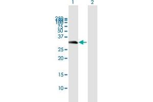 Western Blot analysis of C16orf57 expression in transfected 293T cell line by C16orf57 MaxPab polyclonal antibody. (C16orf57 antibody  (AA 1-265))