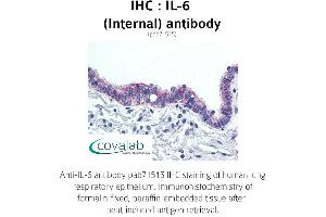 Image no. 1 for anti-Interleukin 6 (IL6) (Internal Region) antibody (ABIN1735888) (IL-6 antibody  (Internal Region))