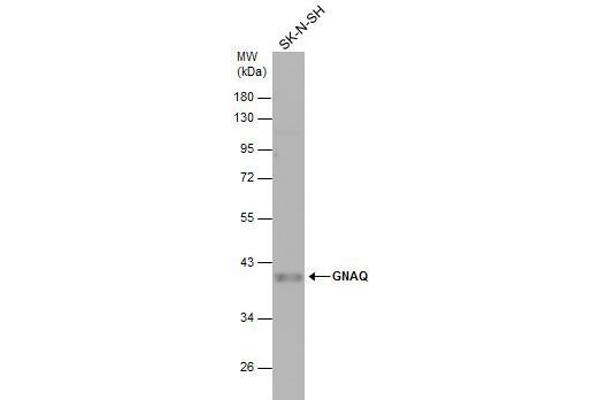 GNAQ antibody  (Center)