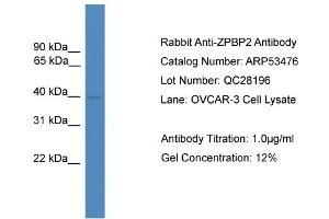 WB Suggested Anti-ZPBP2  Antibody Titration: 0.