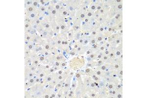 Immunohistochemistry of paraffin-embedded rat liver using WDR48 antibody at dilution of 1:100 (40x lens). (WDR48 antibody)