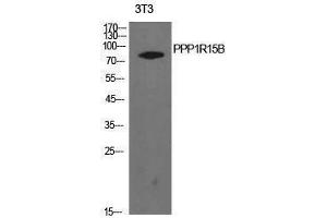 Western Blotting (WB) image for anti-Protein Phosphatase 1, Regulatory Subunit 15B (PPP1R15B) (Internal Region) antibody (ABIN3181424) (PPP1R15B antibody  (Internal Region))