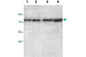 Western blot analysis of HepG2 (Lane 1), HeLa (Lane 2), MCF-7 (Lane 3) and SW480 (Lane 4) cell lysate with AGPS polyclonal antibody  at 1 : 500 dilution. (AGPS antibody  (AA 462-632))