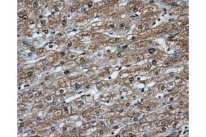 Immunohistochemical staining of paraffin-embedded liver tissue using anti-BTK mouse monoclonal antibody. (BTK antibody)