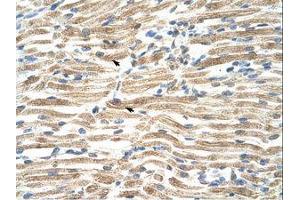 Image no. 1 for anti-YY1 Associated Factor 2 (YAF2) (AA 46-95) antibody (ABIN203352) (YAF2 antibody  (AA 46-95))