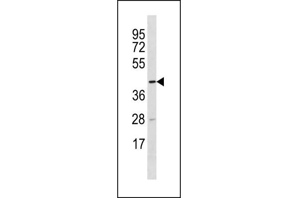 TTC5 antibody  (C-Term)