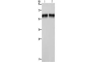 Western Blotting (WB) image for anti-Elastin (ELN) antibody (ABIN2428081) (Elastin antibody)