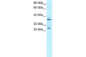 WB Suggested Anti-SIRT5 Antibody Titration:  0. (SIRT5 antibody  (C-Term))