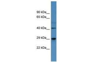 Image no. 1 for anti-Carbonic Anhydrase II (CA2) (AA 130-179) antibody (ABIN6746751) (CA2 antibody  (AA 130-179))
