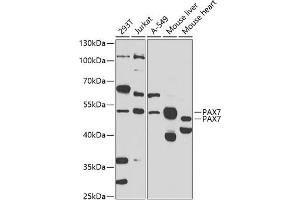 Western blot analysis of extracts of various cell lines, using P antibody (ABIN6132464, ABIN6145263, ABIN6145265 and ABIN6223179) at 1:1000 dilution. (PAX7 antibody  (AA 289-518))