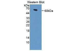 Western Blotting (WB) image for anti-Low Density Lipoprotein Receptor-Related Protein 4 (LRP4) (AA 1610-1885) antibody (ABIN1869037) (LRP4 antibody  (AA 1610-1885))