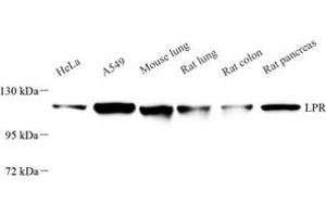 Western blot analysis of LRP (ABIN7074548) at dilution of 1: 500 (MVP antibody)