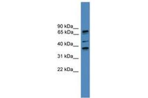 Image no. 1 for anti-Bardet-Biedl Syndrome 5 (BBS5) (N-Term) antibody (ABIN6746105)
