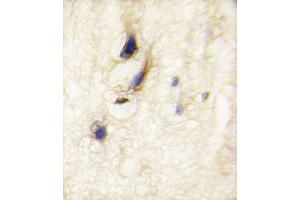 Immunohistochemistry (Paraffin-embedded Sections) (IHC (p)) image for anti-Dishevelled Associated Activator of Morphogenesis 1 (DAAM1) (AA 1034-1063), (C-Term) antibody (ABIN389180)