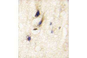 Formalin-fixed and paraffin-embedded human brain tissue reacted with DM1 Antibody (C-term) (ABIN389180 and ABIN2839343) , which was peroxidase-conjugated to the secondary antibody, followed by DAB staining. (DAAM1 antibody  (C-Term))